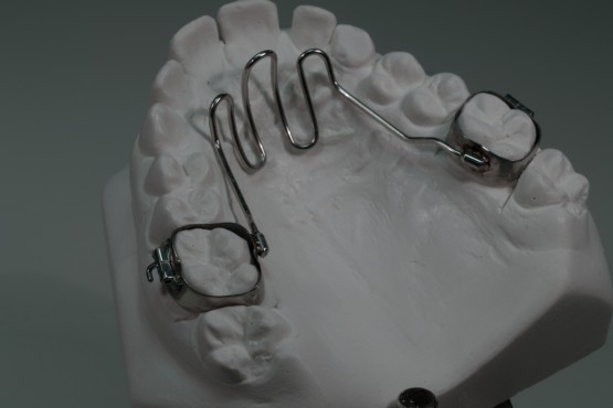 Arc Lingual B Ortho Arc Lingual B Ortho