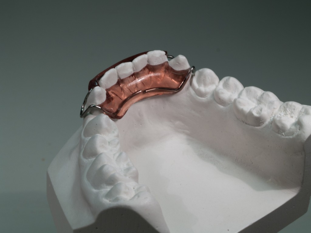 Spring Retainer BOrtho