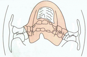 image32