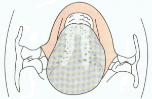 image33